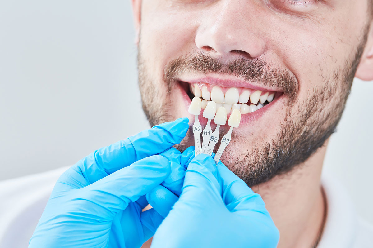 Correcting Gum Recession: A Full Guide