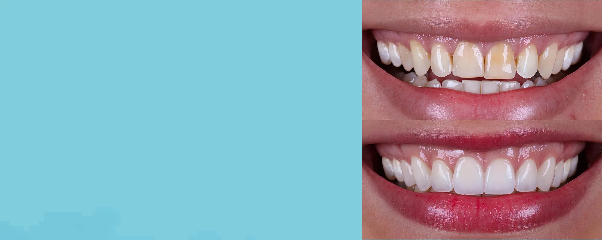Whittier Premier Dental: Dentist in Whittier, CA — Dentistry clinic in Whittier, CA — photo 2